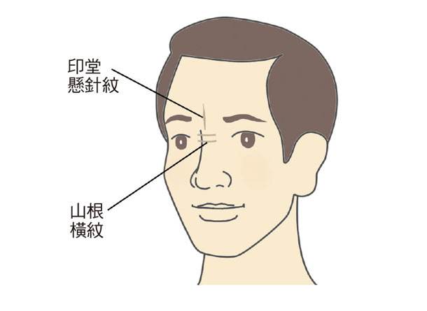 不断头 纹：头纹开是啥意思 