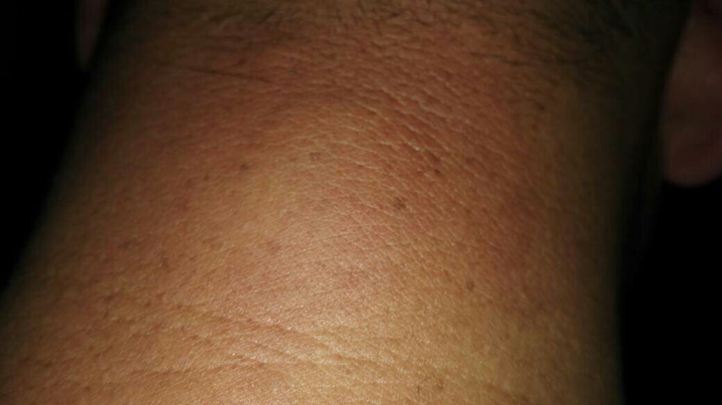 身体不断瘙痒：身体总是痒个不停怎么办 