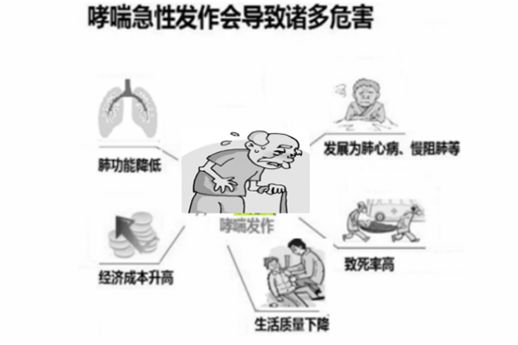 突发变异哮喘：变异性哮喘发病率 