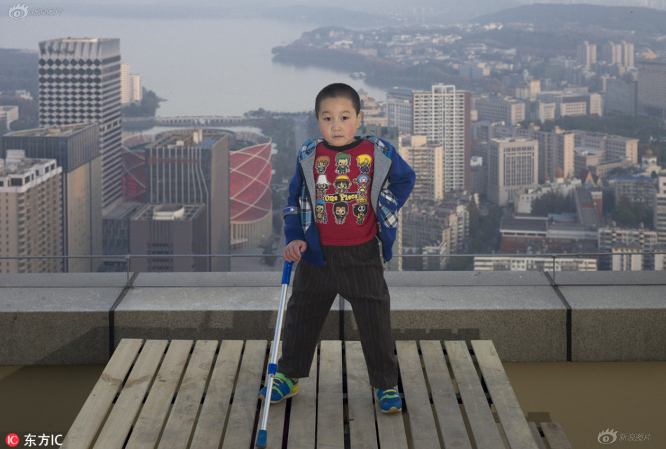 东莞截肢男孩的康复进展与最新动态更新