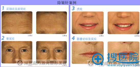 高效的整形价格：整形价格对比一览表 