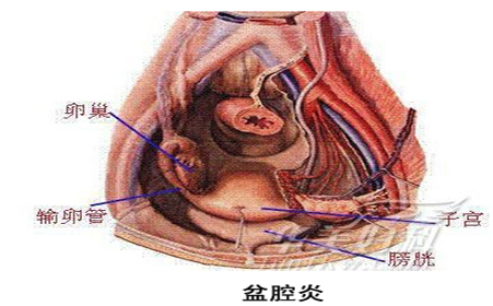 守护女性魅力，盆腔健康是关键——全面解读盆腔养护秘籍
