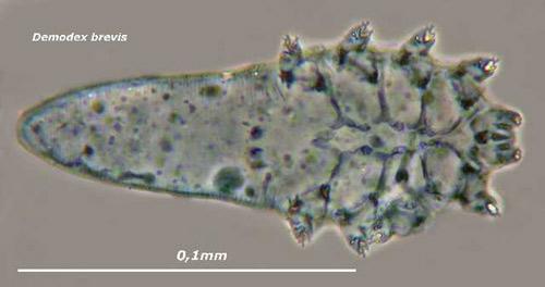 螨虫百科，深入了解螨虫的世界