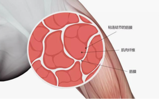 筋膜贴宣传:筋膜视频
