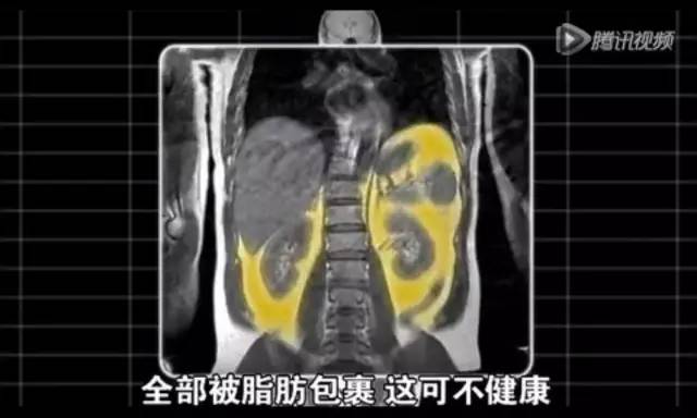 高效运动策略助你内脏脂肪大减！